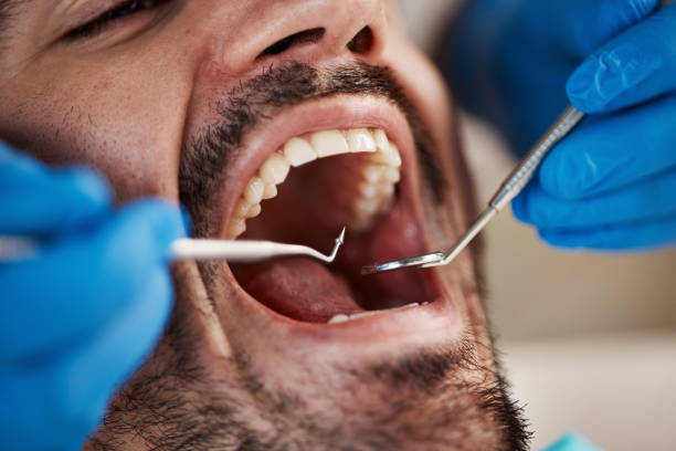 Best Emergency TMJ Treatment in Maineville, OH