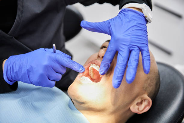 Best Urgent Care for Lost Fillings or Crowns in Maineville, OH
