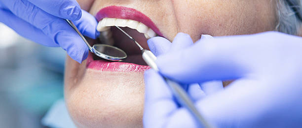 Best Emergency Treatment for Dental Infections or Abscesses in Maineville, OH